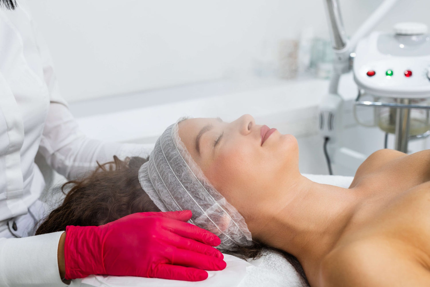 Voksenakne og bumser efter teenagealderen