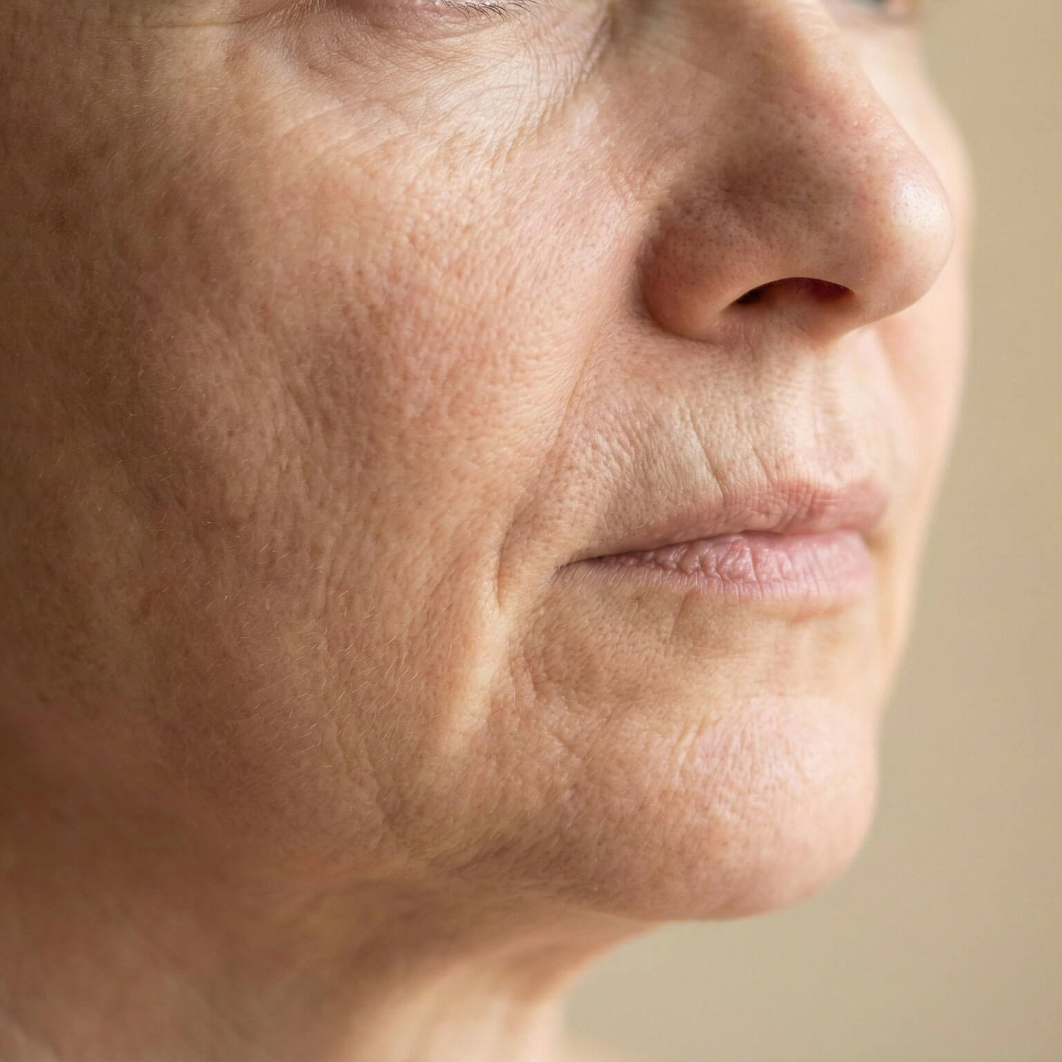 Rynker & anti-aging