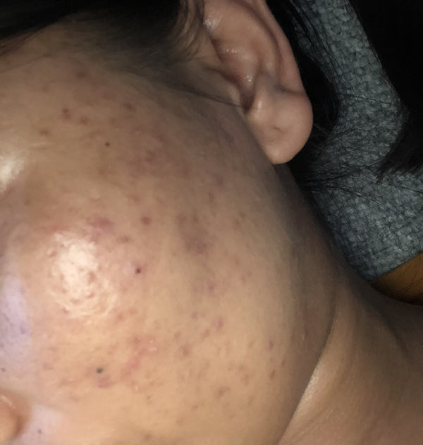 Before image for recvXY6bPgI6sCSIN