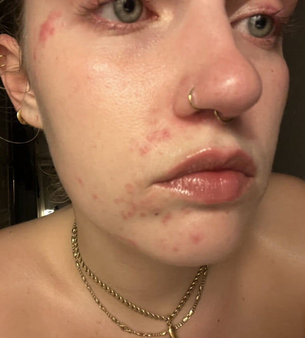 Before image for recwoZAMZjcKa0m4J