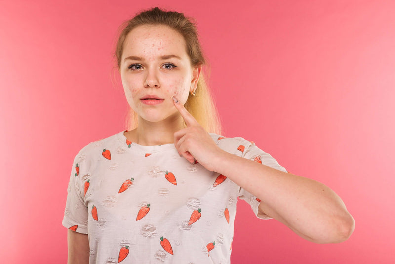 Pustler: hvad er det og hvordan behandles de?