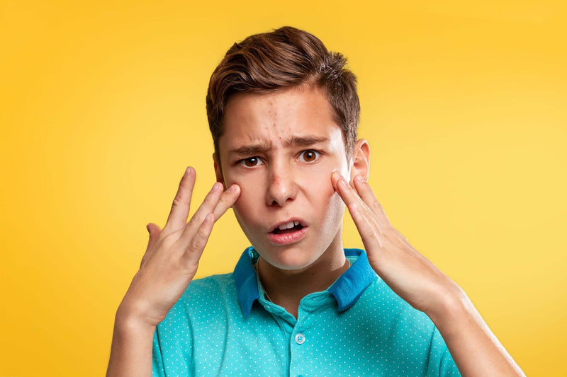 Isotretinoin: Behandling af voldsom tilfælde af acne
