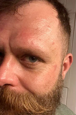 Før-billede af kundehistorie