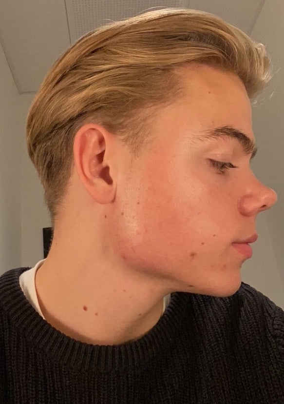 Efter-billede af kundehistorie