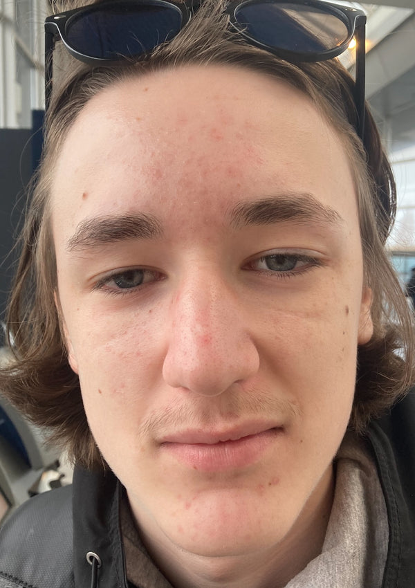 Efter-billede af kundehistorie