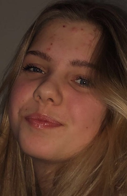 Før-billede af kundehistorie