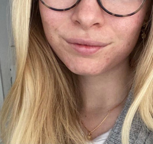 Før-billede af kundehistorie