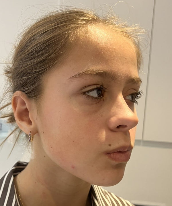 Efter-billede af kundehistorie