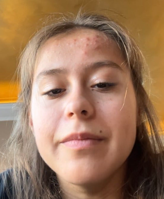 Before image for recAFYkwWH44qmbAO