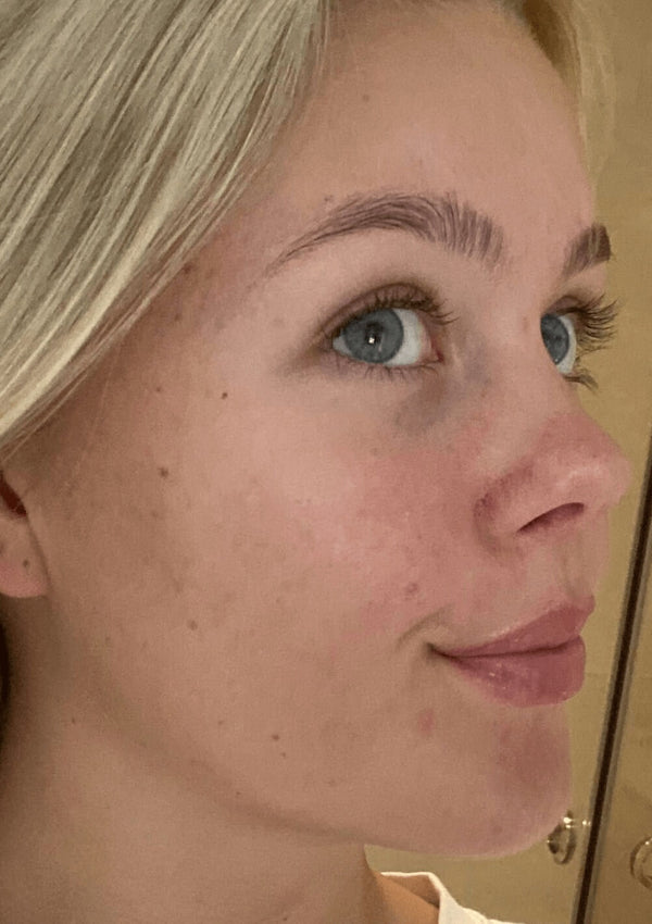 Efter-billede af kundehistorie