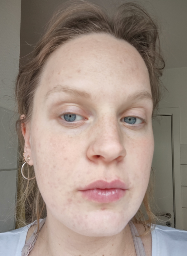 Efter-billede af kundehistorie