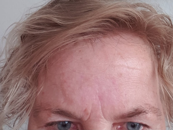 Efter-billede af kundehistorie