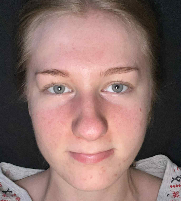 Efter-billede af kundehistorie