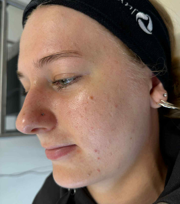 Before image for recDzZLOtT0w2aCpf