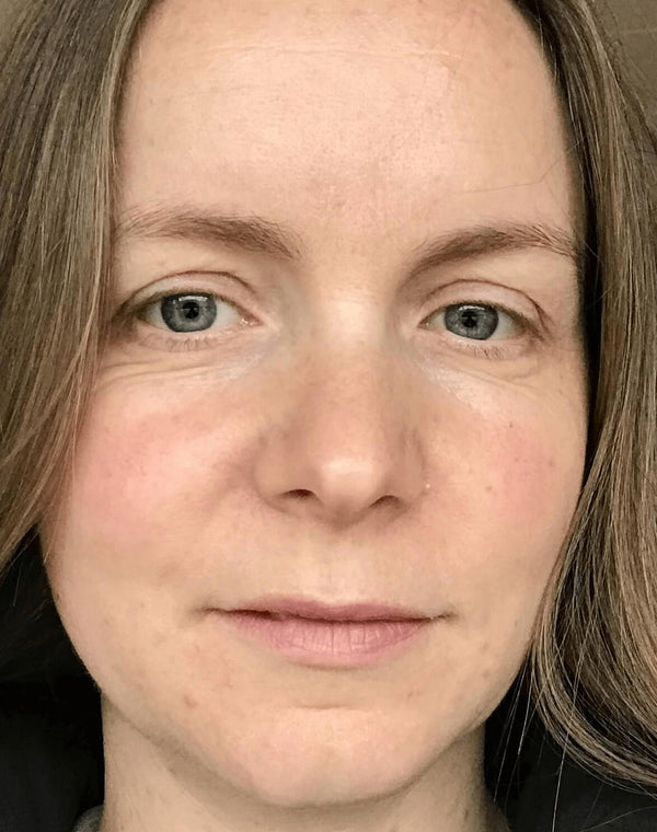 Efter-billede af kundehistorie