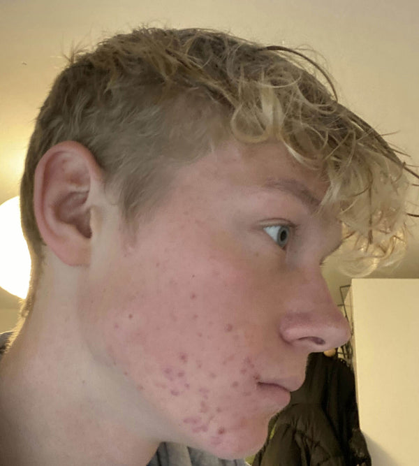 Efter-billede af kundehistorie
