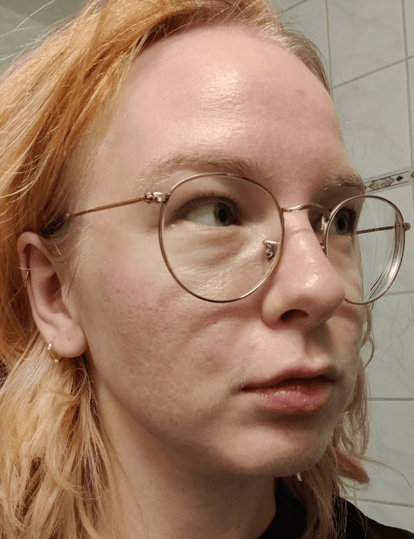 Efter-billede af kundehistorie