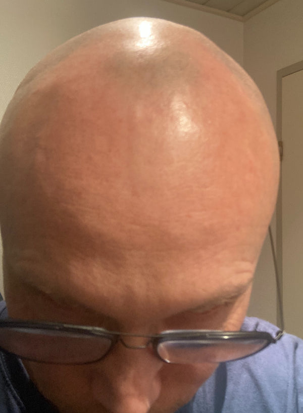 Efter-billede af kundehistorie