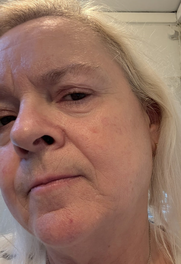 Before image for recS8Ly8G4UqZtwi0