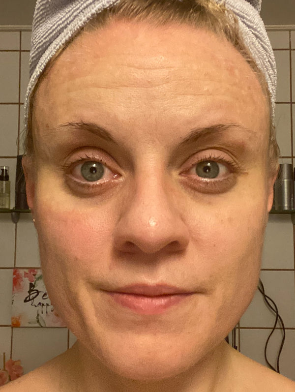 Efter-billede af kundehistorie