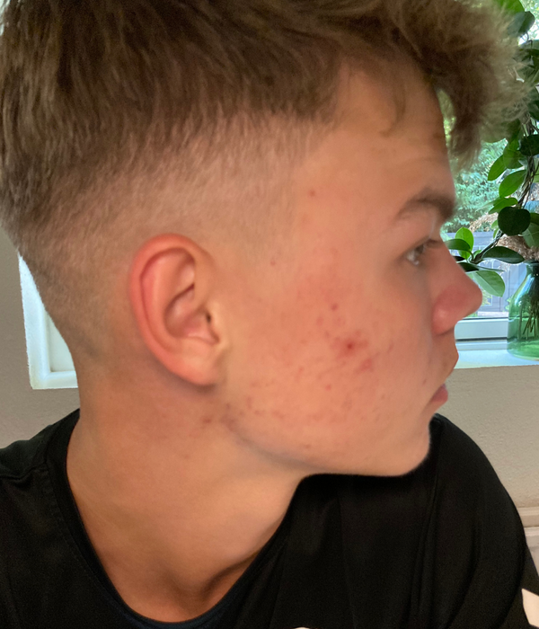Efter-billede af kundehistorie