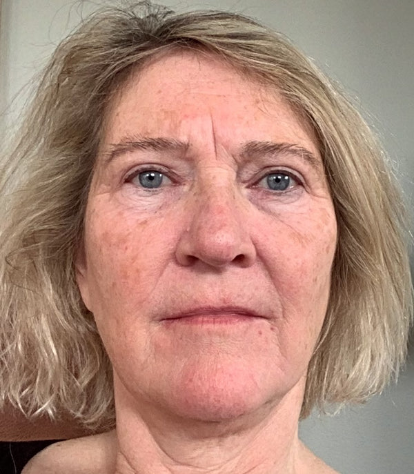 Efter-billede af kundehistorie