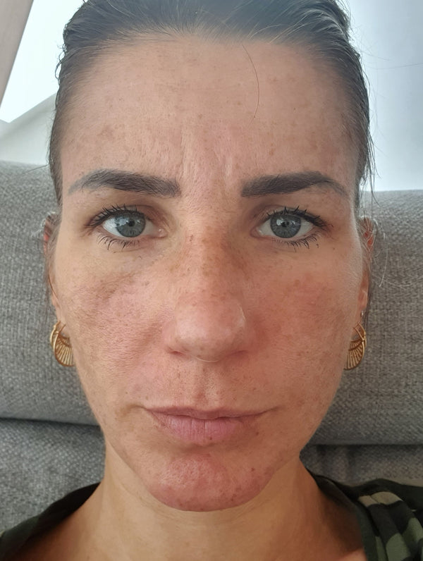 Efter-billede af kundehistorie