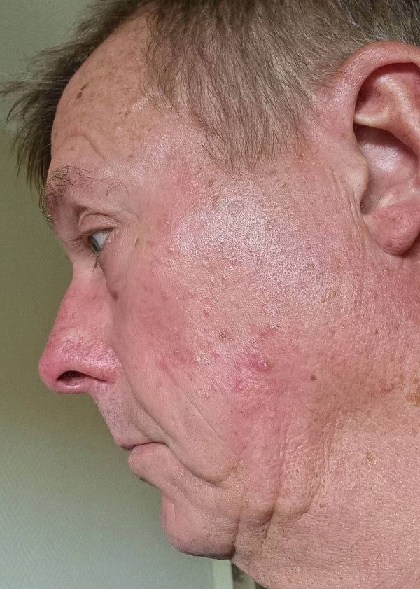 Før-billede af kundehistorie