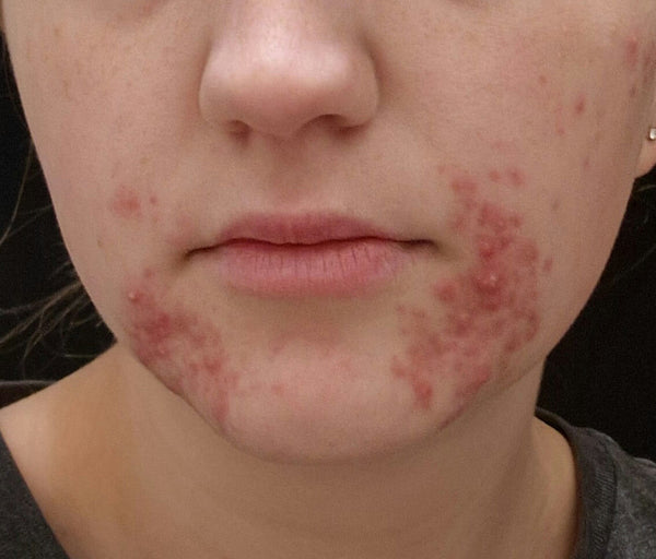 Before image for recmMU5VlzoXlZYgQ