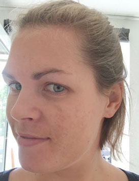 Efter-billede af kundehistorie