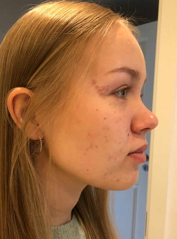 Efter-billede af kundehistorie