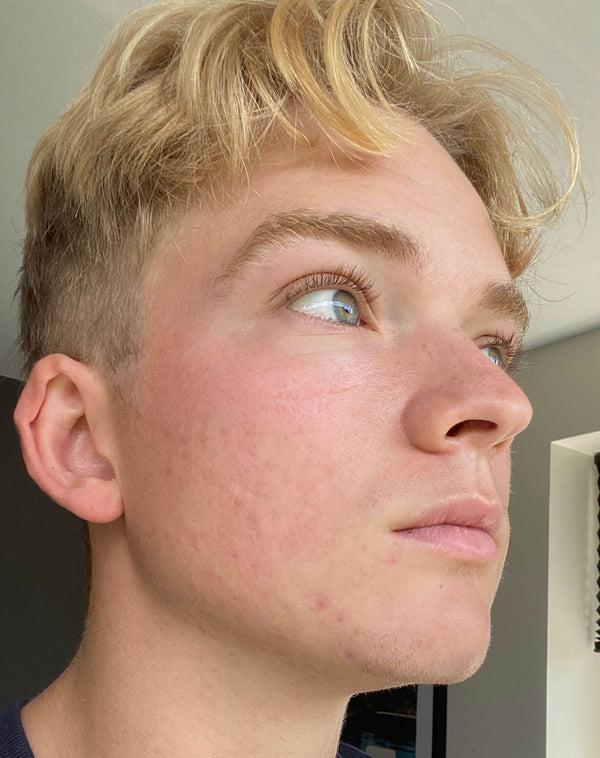 Efter-billede af kundehistorie