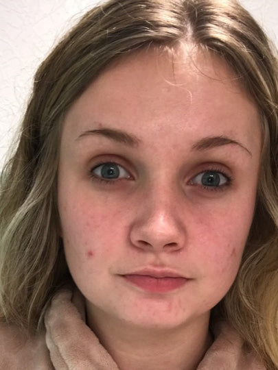 Efter-billede af kundehistorie