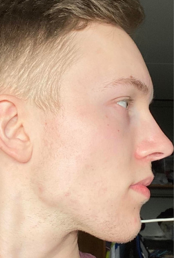 Efter-billede af kundehistorie